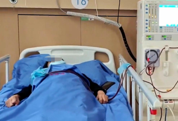 牛势策略 一家6口吃皮蛋4人中毒，其中2人危急做血液透析 医生：沙门氏菌感染，食用前需充分加热